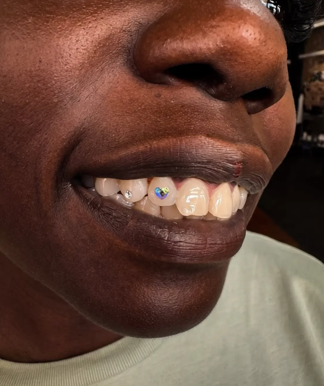 Tooth Gem Pop UP
